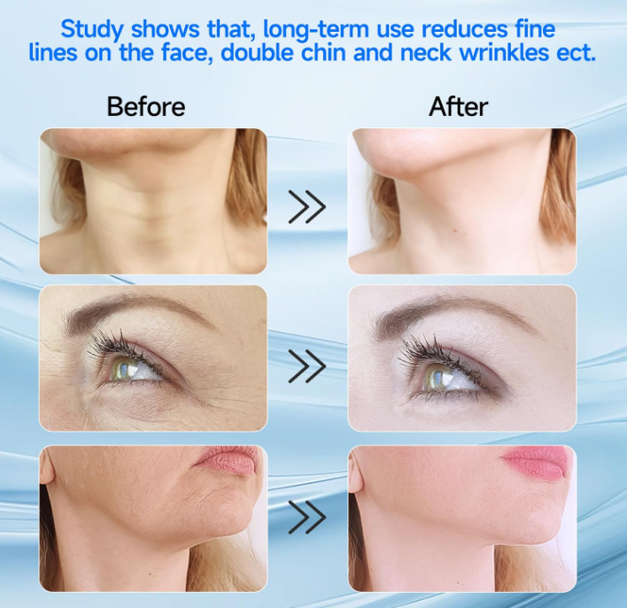 Nexus™ Facial Massager (Led Warm Deep Skin)